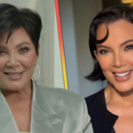 kris jenner face lift